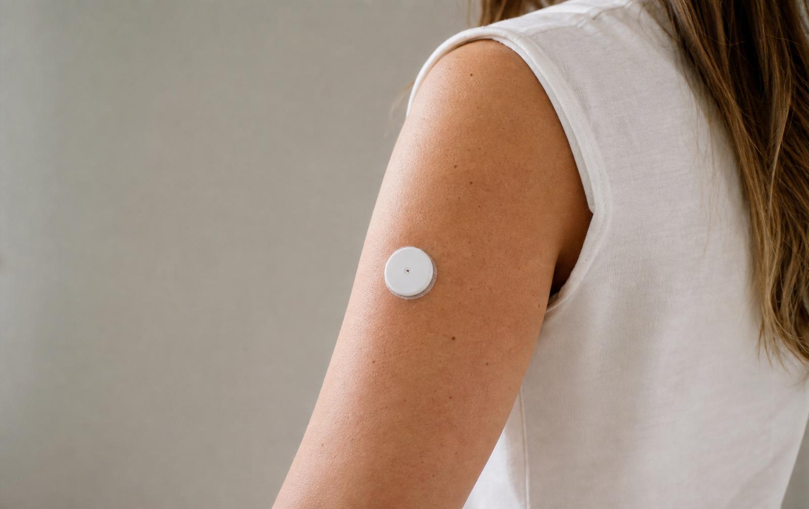 Naise õlavarrel pidev glükoosi monitor (CGM sensor)